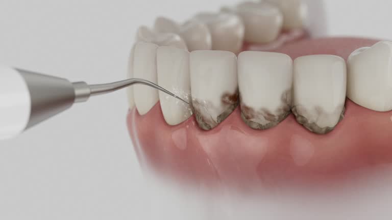 Reliable Dental Implants contractor in Buena Vista city County, VA by Dentist Open Now